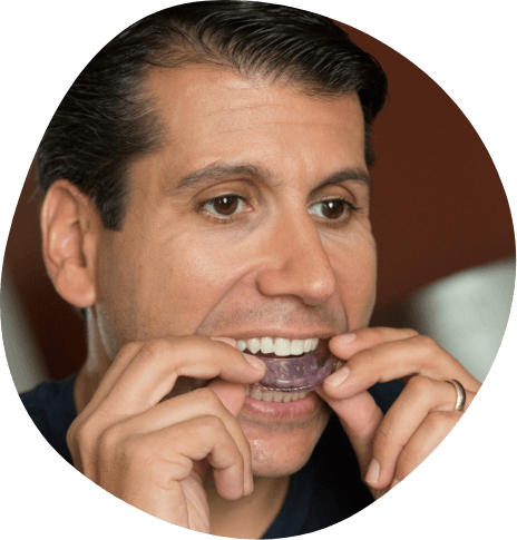 Man placing light purple oral appliance into his mouth