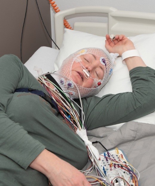 Sleeping woman hooked up to electrodes for sleep testing in Dallas