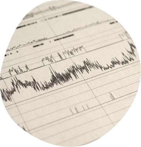 Chart showing oxygenation levels during sleep test