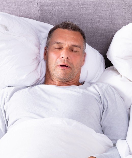 Man sleeping with mouth open before snoring treatment in Dallas